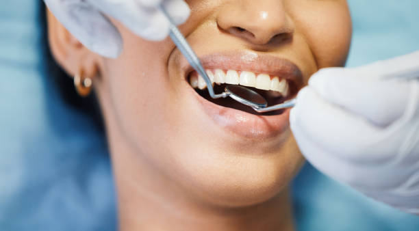 Best Emergency Broken Tooth Repair in Deer Lodge, MT