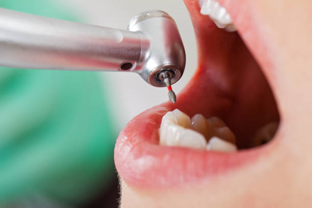 Best Walk-In Emergency Dentist in Deer Lodge, MT